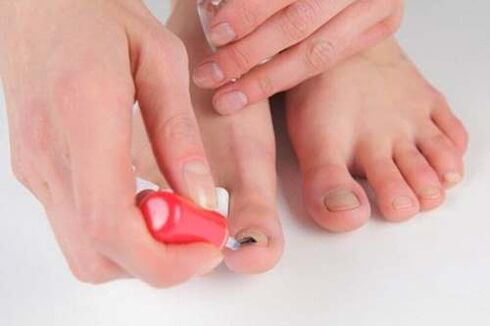 Vernizes de unhas