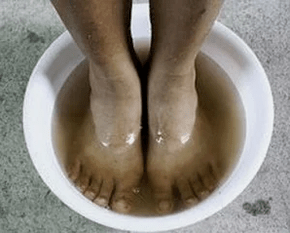 Regras para tratar o fungo das unhas